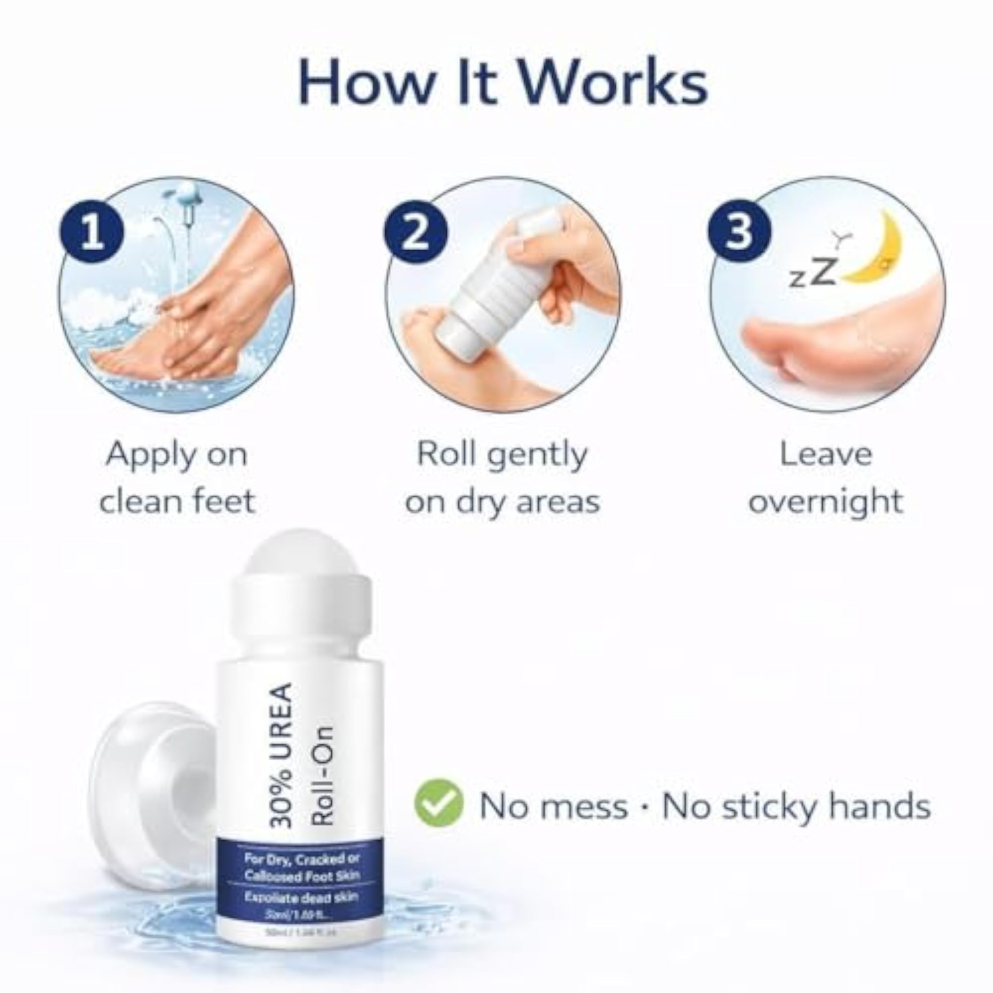 30% Urea Foot Cream Roll-On for Dry & Cracked Heels, Moisturizing